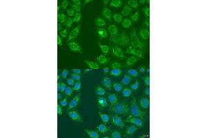 Immunofluorescence analysis of U2OS cells using HSD17B3 antibody (ABIN2736919) at dilution of 1:100. (HSD17B3 Antikörper)