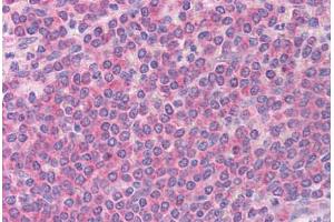 Human Spleen (formalin-fixed, paraffin-embedded) stained with BCL2L11 antibody ABIN213909 at 5 ug/ml followed by biotinylated goat anti-rabbit IgG secondary antibody ABIN481713, alkaline phosphatase-streptavidin and chromogen. (BIM Antikörper  (Internal Region))
