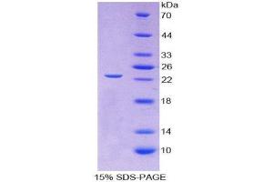 SDS-PAGE (SDS) image for Gremlin 1 (GREM1) (AA 26-184) protein (His tag) (ABIN2125075)