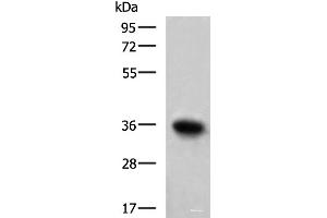 Western blot analysis of Mouse skeletal muscle tissue lysate using TNNT1 Polyclonal Antibody at dilution of 1:550 (TNNT1 Antikörper)