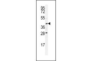 USP50 Antibody (Center) (ABIN655200 and ABIN2844815) western blot analysis in Y79 cell line lysates (35 μg/lane). (USP50 Antikörper  (AA 141-169))