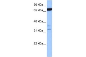 Western Blotting (WB) image for anti-Zinc Finger Protein 340 (ZNF340) antibody (ABIN2463360) (ZBTB46 Antikörper)