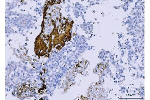 IHC analysis of Integrin beta 3/ITGB3 using anti-Integrin beta 3/ITGB3 antibody (ABIN7601139). (Integrin beta 3 Antikörper  (AA 29-523))