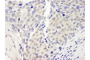 Immunohistochemistry (IHC) image for anti-Zinc Finger Protein 592 (ZNF592) (AA 950-1000) antibody (ABIN7448883)