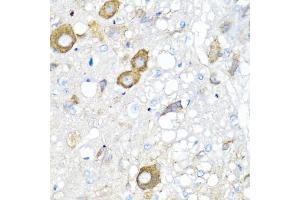 Immunohistochemistry of paraffin-embedded rat brain using MGP antibody (ABIN5975376) at dilution of 1/100 (40x lens). (MGP Antikörper)