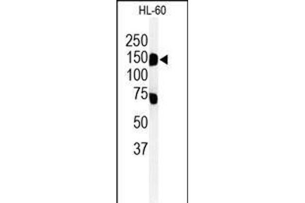 TMEM131L Antikörper  (C-Term)