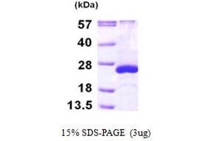 SDS-PAGE (SDS) image for ADP-Ribosylation Factor-Like 5A (ARL5A) (AA 1-179) protein (His tag) (ABIN667845)