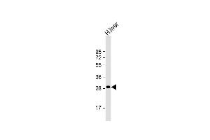 Anti-QDPR Antibody (C-term) at 1:1000 dilution + human liver lysate Lysates/proteins at 20 μg per lane. (QDPR Antikörper  (C-Term))