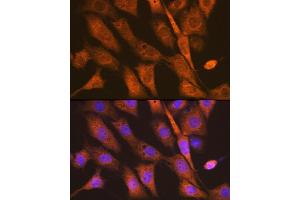 Immunofluorescence analysis of NIH-3T3 cells using PEN2/PSENEN Rabbit mAb (ABIN7269513) at dilution of 1:100 (40x lens). (PEN2 Antikörper)