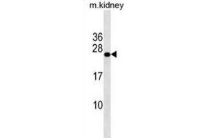 Western Blotting (WB) image for anti-GrpE-Like 2, Mitochondrial (GRPEL2) antibody (ABIN3000757) (GRPEL2 Antikörper)