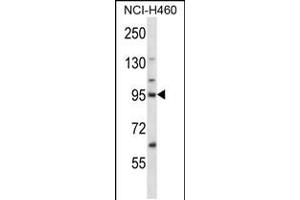 Western blot analysis in NCI-H460 cell line lysates (35ug/lane). (KIF2C Antikörper  (N-Term))