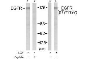 Image no. 1 for anti-Epidermal Growth Factor Receptor (EGFR) (pTyr1197) antibody (ABIN196974) (EGFR Antikörper  (pTyr1197))