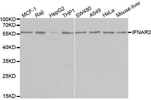 Western blot analysis of extracts of various cell lines, using IFNAR2 antibody (ABIN5970890) at 1/1000 dilution. (IFNAR2 Antikörper)