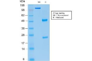 SDS-PAGE Analysis Purified p21 Mouse Recombinant Monoclonal Antibody (rCIP1/823). (Rekombinanter p21 Antikörper)