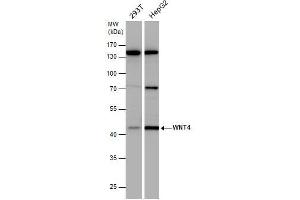WB Image WNT4 antibody detects WNT4 protein by western blot analysis. (WNT4 Antikörper  (Center))