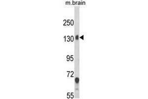 Western blot analysis of CACNA2D1 Antibody (N-term) in mouse brain tissue lysates (35ug/lane). (CACNA2D1 Antikörper  (N-Term))
