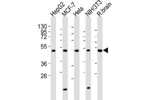 All lanes : Anti-P2R2A Antibody (N-term) at 1:2000 dilution Lane 1: HepG2 whole cell lysates Lane 2: MCF-7 whole cell lysates Lane 3: Hela whole cell lysates Lane 4: NIH/3T3 whole cell lysates Lane 5: rat brain lysates Lysates/proteins at 20 μg per lane. (PPP2R2A Antikörper  (N-Term))