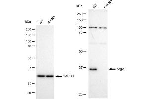 Western blotting analysis using Arg2 antibody (ABIN7797644). (Rekombinanter ARG2 Antikörper)