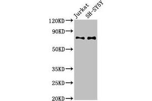 Western Blot Positive WB detected in: Jurkat whole cell lysate, SH-SY5Y whole cell lysate All lanes: RAVER2 antibody at 3 μg/mL Secondary Goat polyclonal to rabbit IgG at 1/50000 dilution Predicted band size: 75, 73 kDa Observed band size: 75 kDa (RAVER2 Antikörper  (AA 2-691))