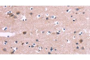 Immunohistochemistry of paraffin-embedded Human brain tissue using DUSP13 Polyclonal Antibody at dilution 1:60 (DUSP13 Antikörper)