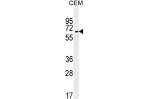 Western Blotting (WB) image for anti-UNC Homeobox (UNCX) antibody (ABIN2996063) (UNCX Antikörper)