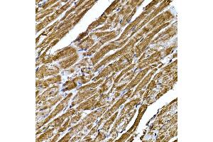 Immunohistochemistry of paraffin-embedded mouse heart using BNP Rabbit pAb (ABIN3023135, ABIN3023136, ABIN3023137, ABIN1513273 and ABIN6219406) at dilution of 1:200 (40x lens). (NPPB Antikörper  (AA 1-134))