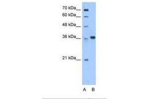 Image no. 1 for anti-Aminoadipate-Semialdehyde Dehydrogenase-phosphopantetheinyl Transferase (AASDHPPT) (C-Term) antibody (ABIN6738500) (AASDHPPT Antikörper  (C-Term))
