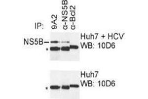Western Blotting (WB) image for anti-Hepatitis C Virus NS5 (HCV NS5) (AA 111-130) antibody (ABIN781784) (HCV NS5 Antikörper  (AA 111-130))