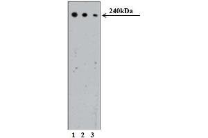Western blot analysis of CRIK on Human Jurkat cell lysate (ATCC TIB-152). (CIT Antikörper  (AA 1420-1612))