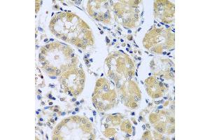 Immunohistochemistry of paraffin-embedded human stomach using FBXL5 antibody at dilution of 1:100 (x40 lens). (FBXL5 Antikörper)
