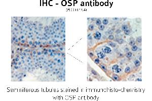 Image no. 1 for anti-Claudin 11 (CLDN11) (C-Term) antibody (ABIN346949) (Claudin 11 Antikörper  (C-Term))