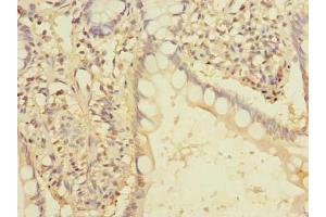 Immunohistochemistry of paraffin-embedded human small intestine tissue using ABIN7166436 at dilution of 1:100 (EEF2KMT (AA 1-330) Antikörper)