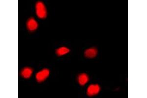 Immunofluorescent analysis of Histone H3 (pT11) staining in HepG2 cells. (Histone 3 Antikörper  (pSer11))