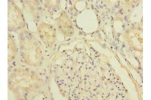 Immunohistochemistry of paraffin-embedded human kidney tissue using ABIN7170191 at dilution of 1:100 (SLC25A36 Antikörper  (AA 58-110))