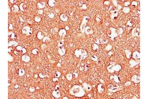 Immunohistochemistry of paraffin-embedded human brain tissue using ABIN7143307 at dilution of 1:100 (Adenosine A2b Receptor Antikörper  (AA 292-332))