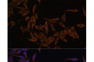 Immunofluorescence analysis of HeLa cells using UBE2L3 Polyclonal Antibody at dilution of 1:100 (40x lens). (UBE2L3 Antikörper)