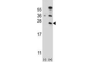 Western Blotting (WB) image for anti-CD3 epsilon (CD3E) (AA 154-182) antibody (ABIN3030389)