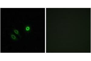 Immunofluorescence analysis of A549 cells, using OR4X1 Antibody. (OR4X1 Antikörper  (AA 256-305))