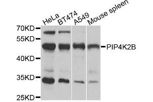 Western blot analysis of extracts of various cells, using PIP4K2B antibody. (PIP4K2B Antikörper)