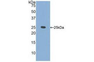 Detection of Recombinant CRADD, Human using Polyclonal Antibody to CASP2 And RIPK1 Domain Containing Adaptor With Death Domain Protein (CRADD) (CRADD Antikörper  (AA 1-199))