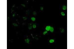 Anti-DNTTIP1 mouse monoclonal antibody (ABIN2452956) immunofluorescent staining of COS7 cells transiently transfected by pCMV6-ENTRY DNTTIP1 (RC206867). (DNTTIP1 Antikörper)