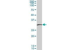 SIX3 monoclonal antibody (M04), clone 1A2. (SIX3 Antikörper  (AA 273-332))
