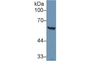 Western Blot; Sample: Human Hela cell lysate; Primary Ab: 1µg/ml Rabbit Anti-Human G6PD Antibody Second Ab: 0. (Glucose-6-Phosphate Dehydrogenase Antikörper  (AA 1-515))
