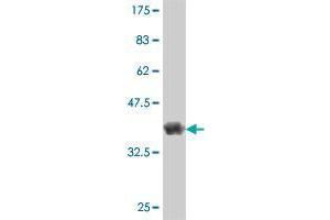 Western Blot detection against Immunogen (36. (MAP3K15 Antikörper  (AA 691-786))