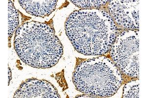 ABIN7095603 and ABIN7099665 at 1/100 staining mouse testis tissue by IHC-P.