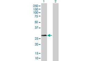 Western Blot analysis of DHRS4 expression in transfected 293T cell line by DHRS4 MaxPab polyclonal antibody. (DHRS4 Antikörper  (AA 1-278))