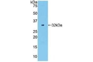 Detection of Recombinant OSMR, Human using Polyclonal Antibody to Oncostatin M Receptor (OSMR) (Oncostatin M Receptor Antikörper  (AA 513-760))