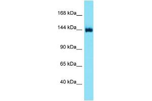 Host: Rabbit  Target Name: Dgkd  Sample Tissue: Mouse Liver lysates  Antibody Dilution: 1. (DGKD Antikörper  (Middle Region))