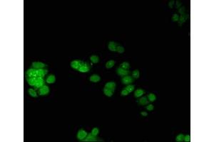 Immunofluorescent analysis of PC-3 cells using ABIN7172771 at dilution of 1:100 and Alexa Fluor 488-congugated AffiniPure Goat Anti-Rabbit IgG(H+L) (ERG Antikörper  (AA 1-486))