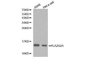 Western Blotting (WB) image for anti-Phospholipase A2, Group IIA (Platelets, Synovial Fluid) (PLA2G2A) (AA 21-144) antibody (ABIN3021802) (PLA2G2A Antikörper  (AA 21-144))